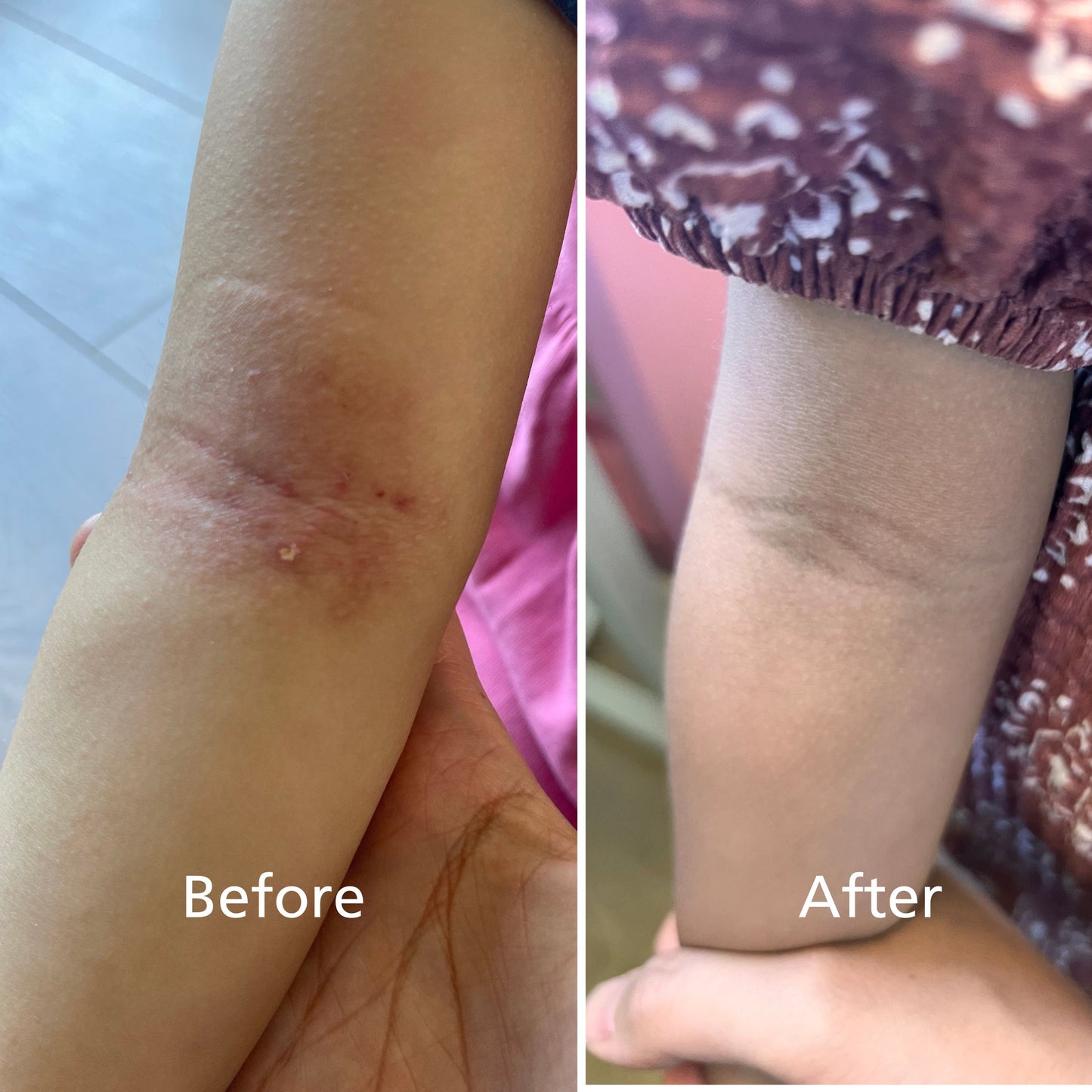 DooBeeDooBum™ - Organic Moisture Healing Balm