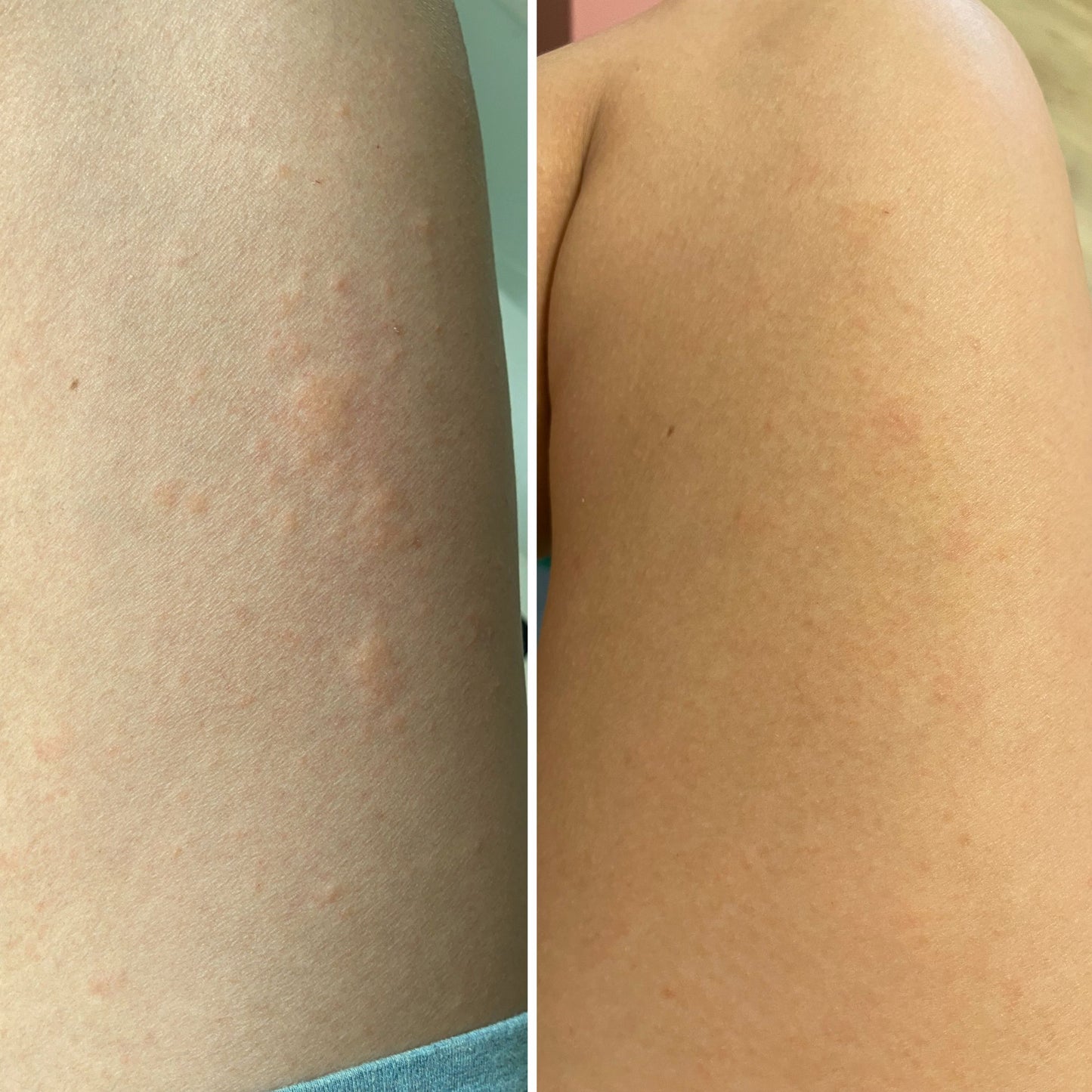 DooBeeDooBum™ - Organic Moisture Healing Balm