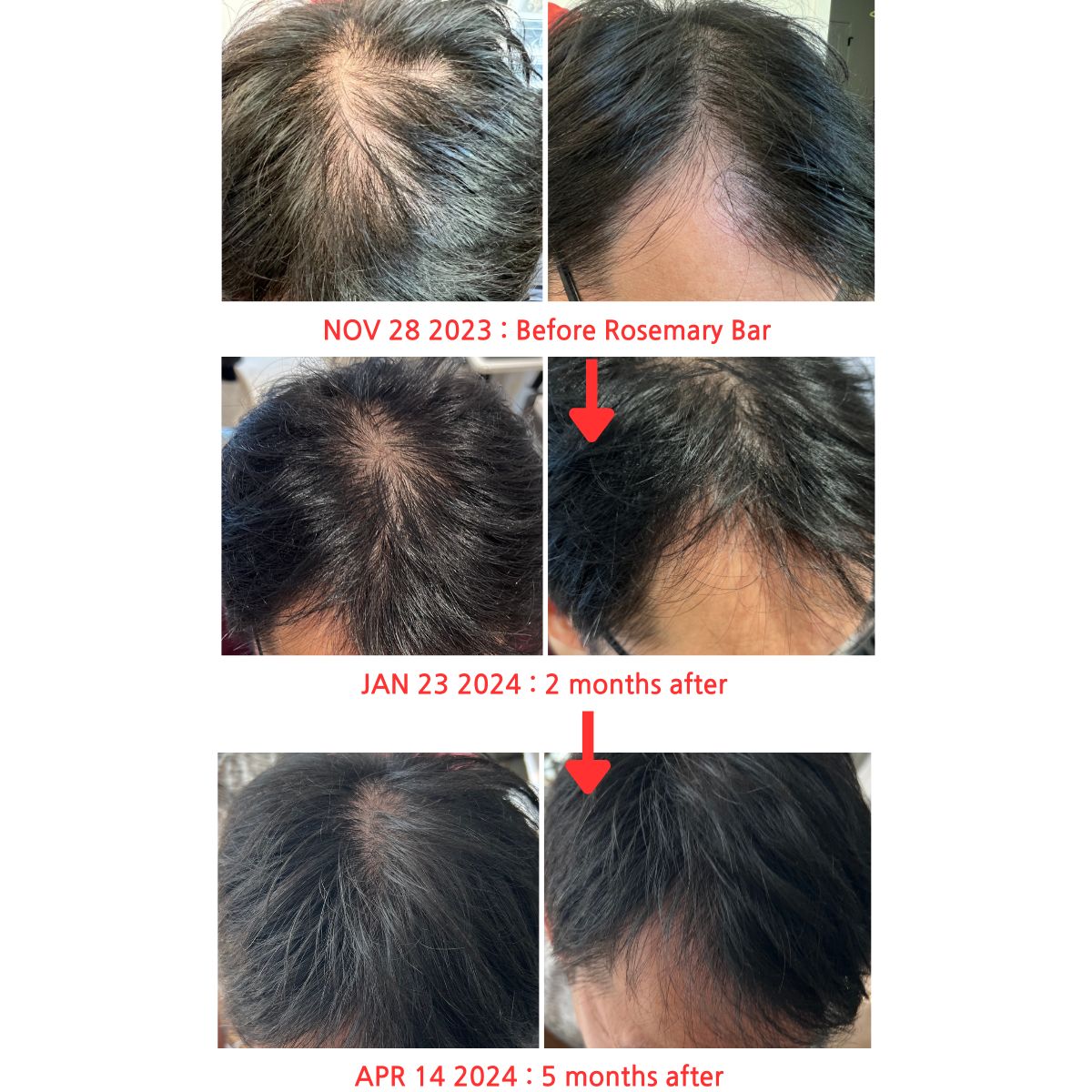 Rosemary Massage Bar from Scalp to Body